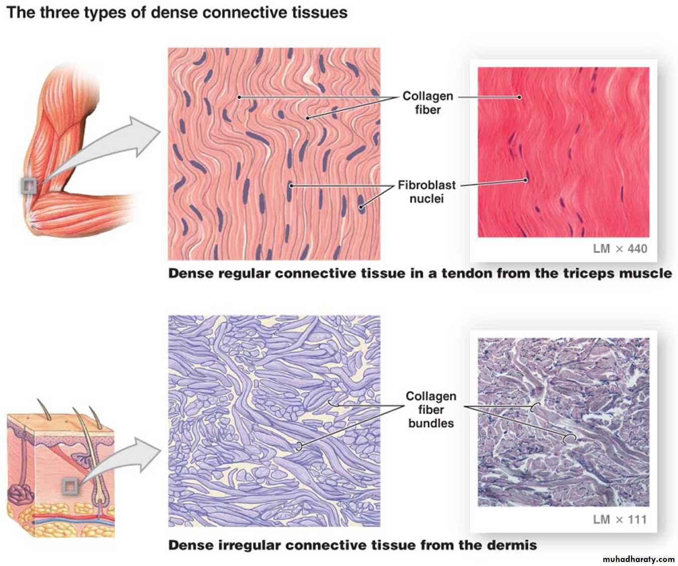 Connective tissue