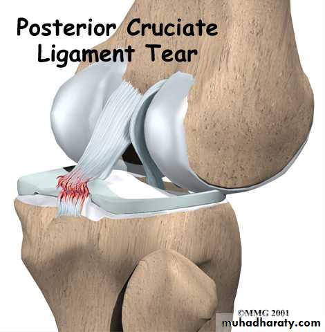 Connective tissue