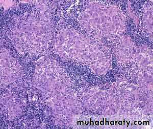 Pathology of lymph nodes