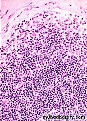 Pathology of lymph nodes
