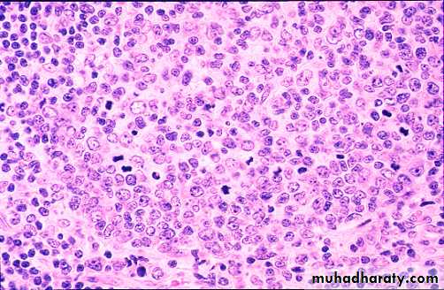 Pathology of lymph nodes