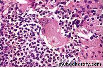 Pathology of lymph nodes