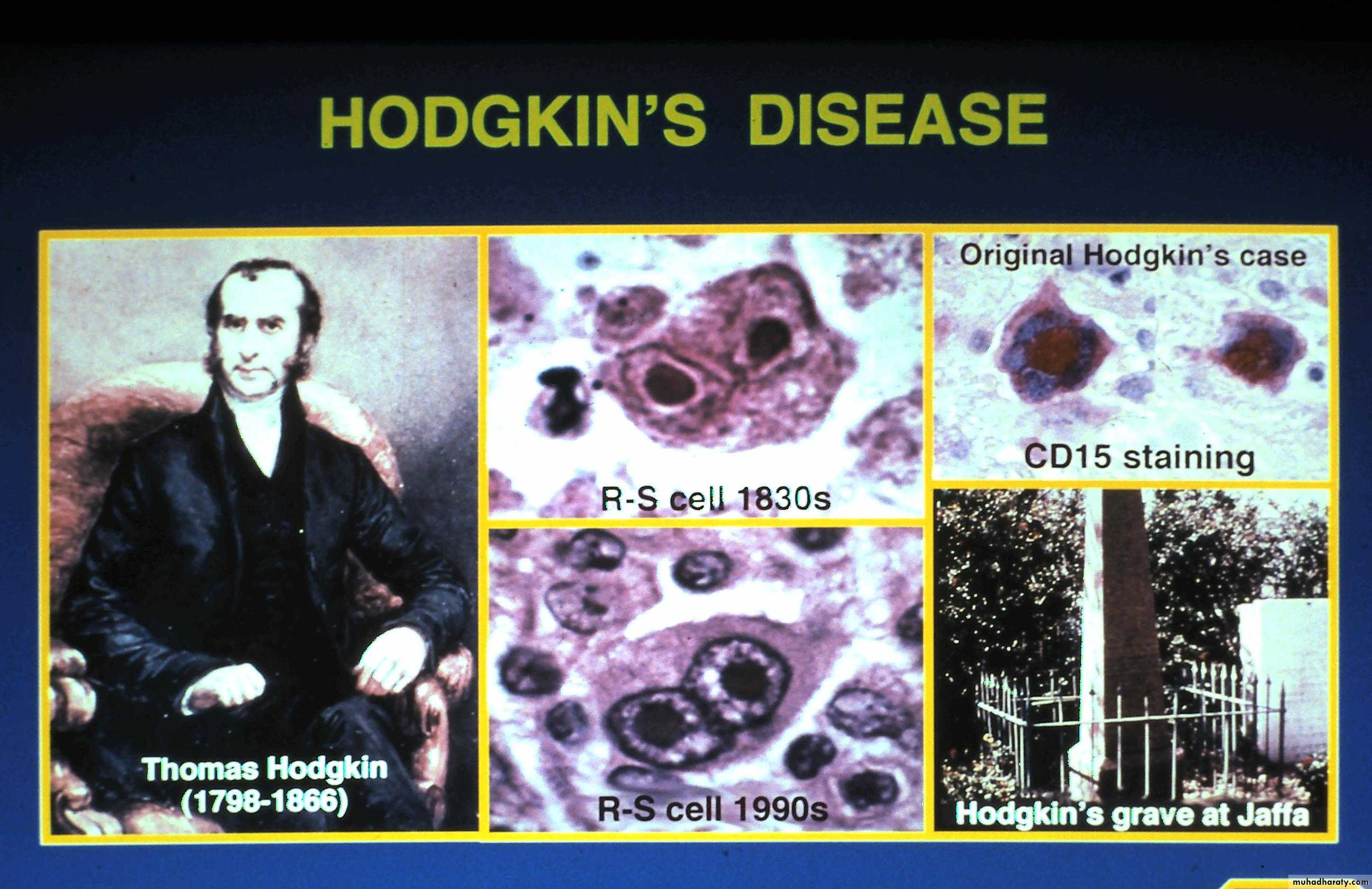Reactive hyperplasia