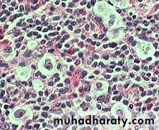 Reactive hyperplasia