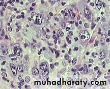 Reactive hyperplasia