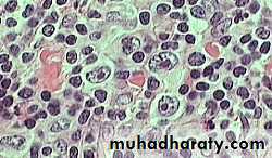 Reactive hyperplasia