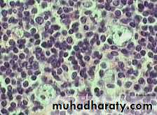 Reactive hyperplasia