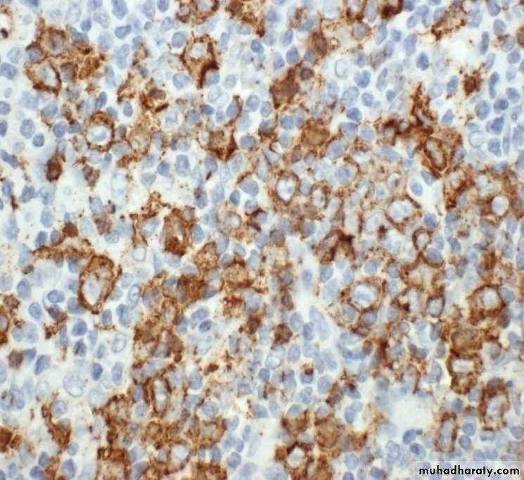Reactive hyperplasia