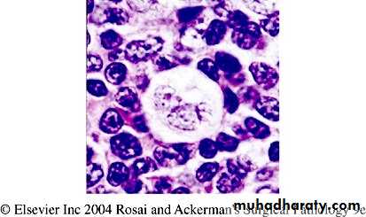 Reactive hyperplasia