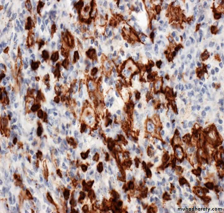 Reactive hyperplasia