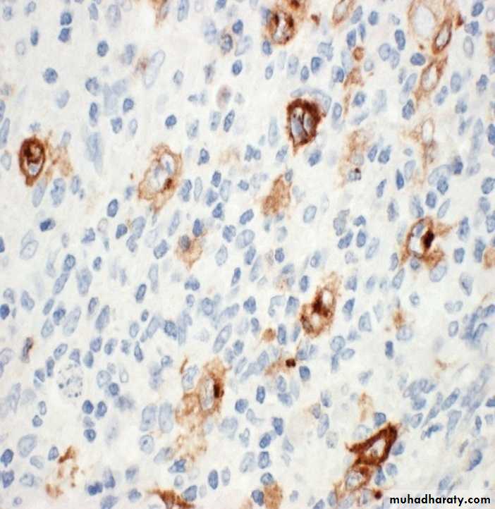 Reactive hyperplasia