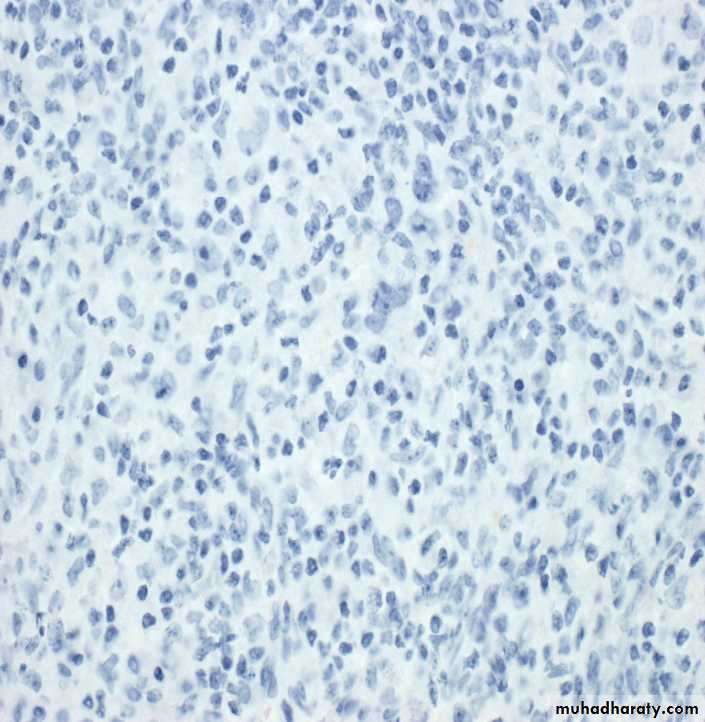 Reactive hyperplasia