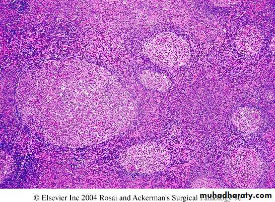 Reactive hyperplasia