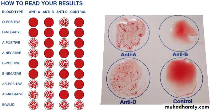 Disorders in Immunity