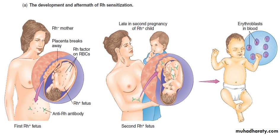 Disorders in Immunity