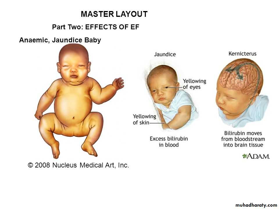 Disorders in Immunity