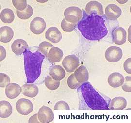 AIDS - HIV