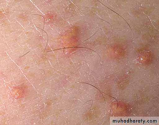 Manifestations of Systemic Diseases