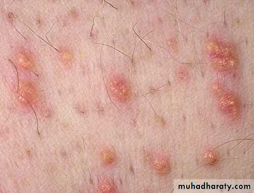 Manifestations of Systemic Diseases