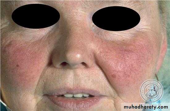 Manifestations of Systemic Diseases