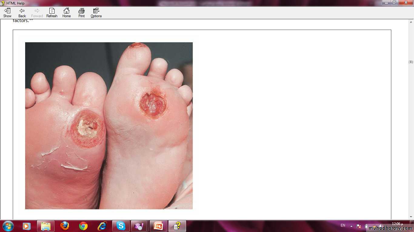 Manifestations of Systemic Diseases