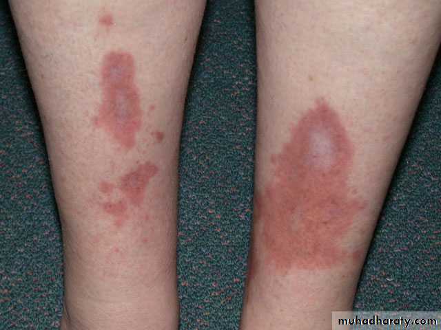 Manifestations of Systemic Diseases