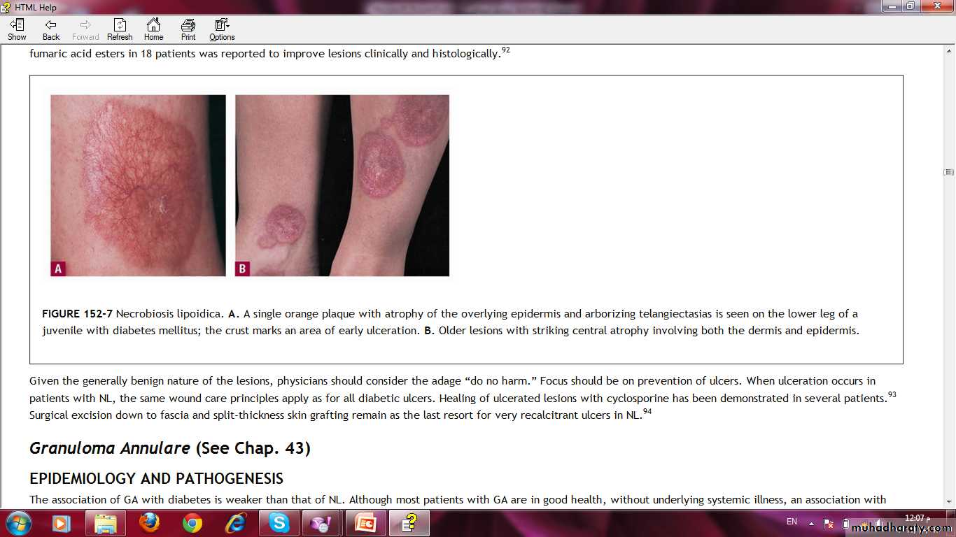 Manifestations of Systemic Diseases