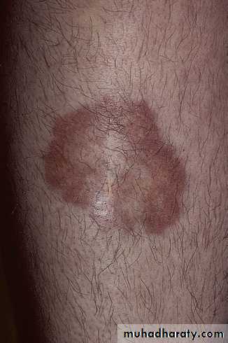 Manifestations of Systemic Diseases