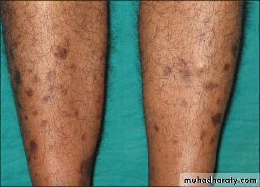 Manifestations of Systemic Diseases