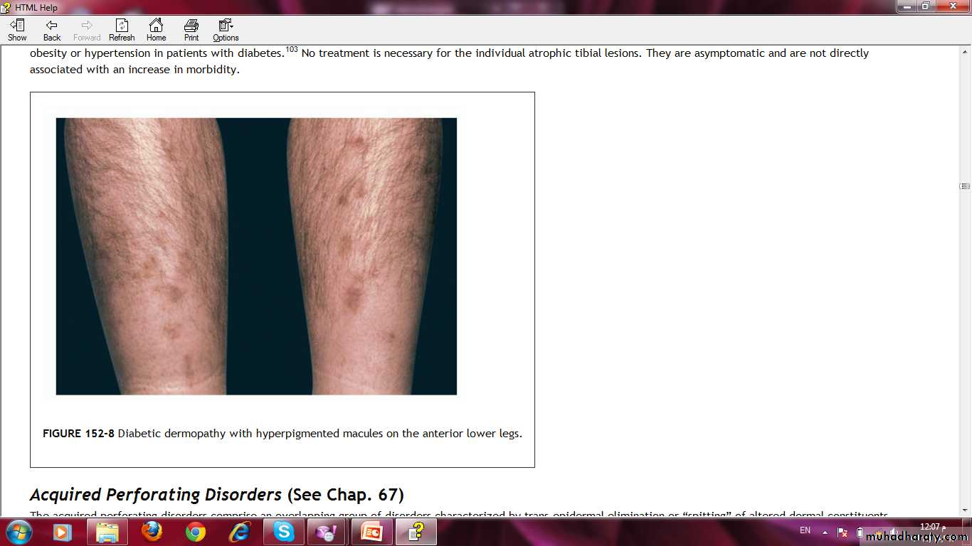 Manifestations of Systemic Diseases