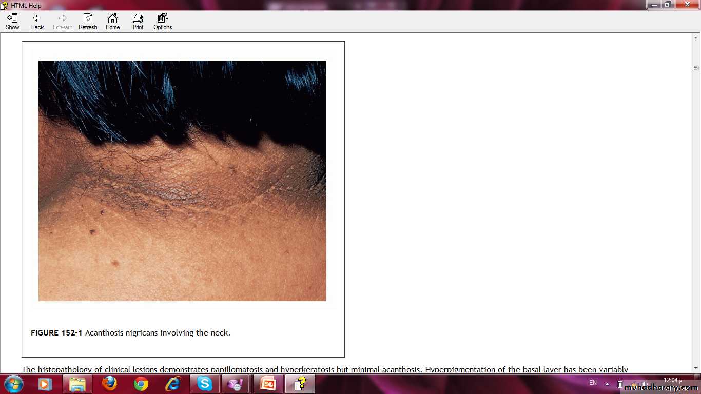 Manifestations of Systemic Diseases
