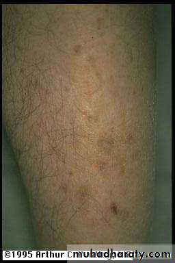 Manifestations of Systemic Diseases