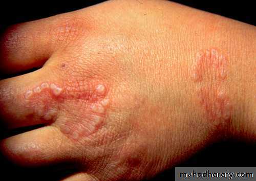 Manifestations of Systemic Diseases
