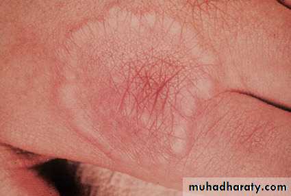 Manifestations of Systemic Diseases