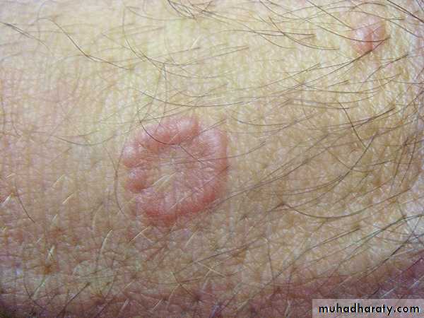Manifestations of Systemic Diseases