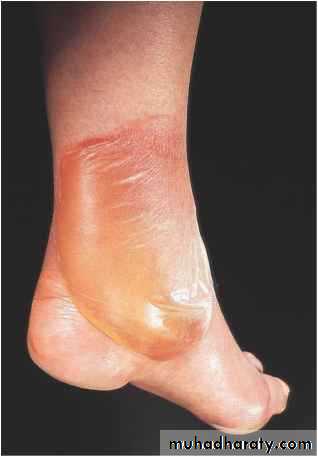 Manifestations of Systemic Diseases
