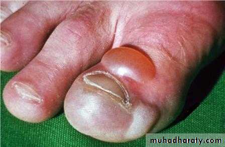 Manifestations of Systemic Diseases