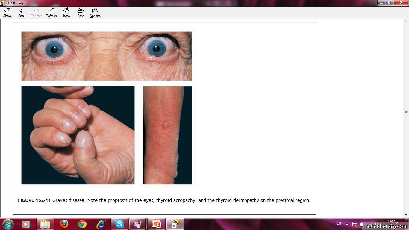 Manifestations of Systemic Diseases