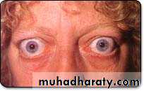 Manifestations of Systemic Diseases