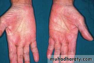 Manifestations of Systemic Diseases