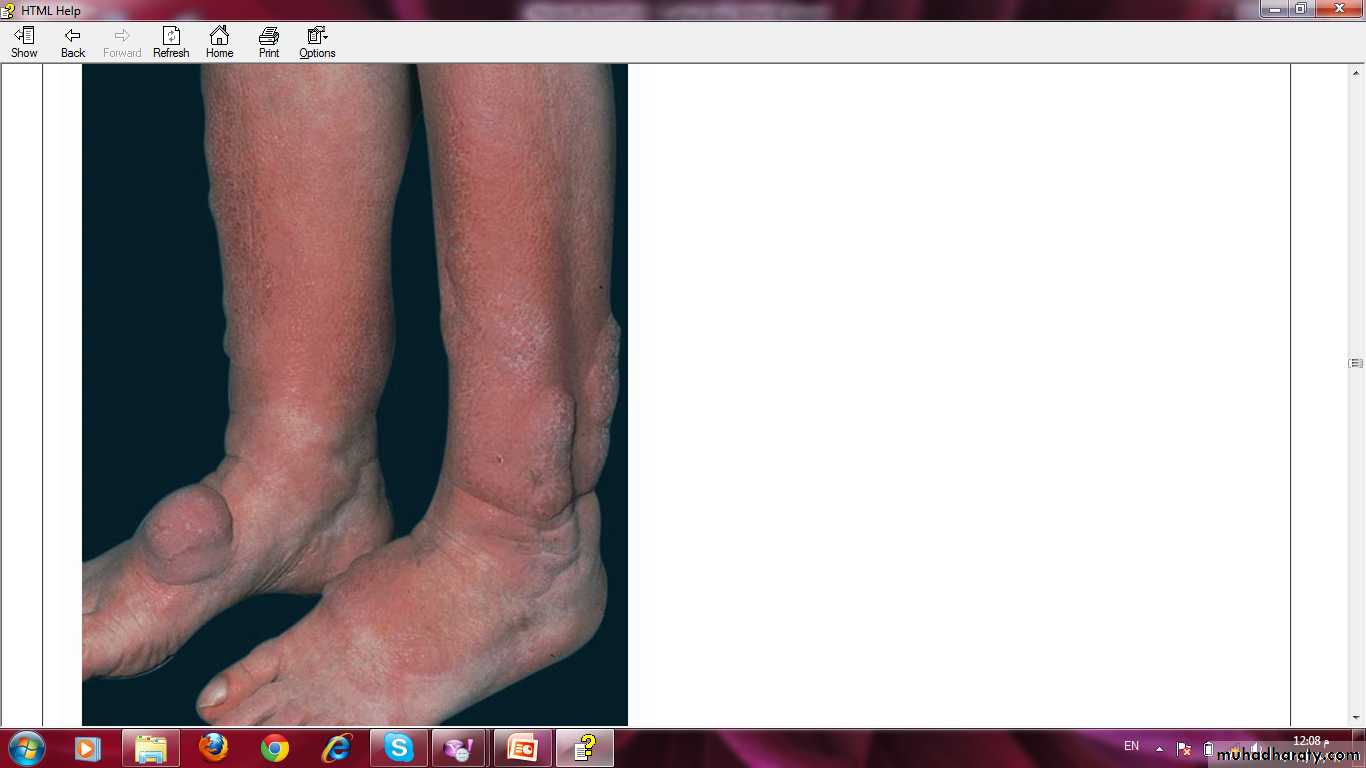 Manifestations of Systemic Diseases