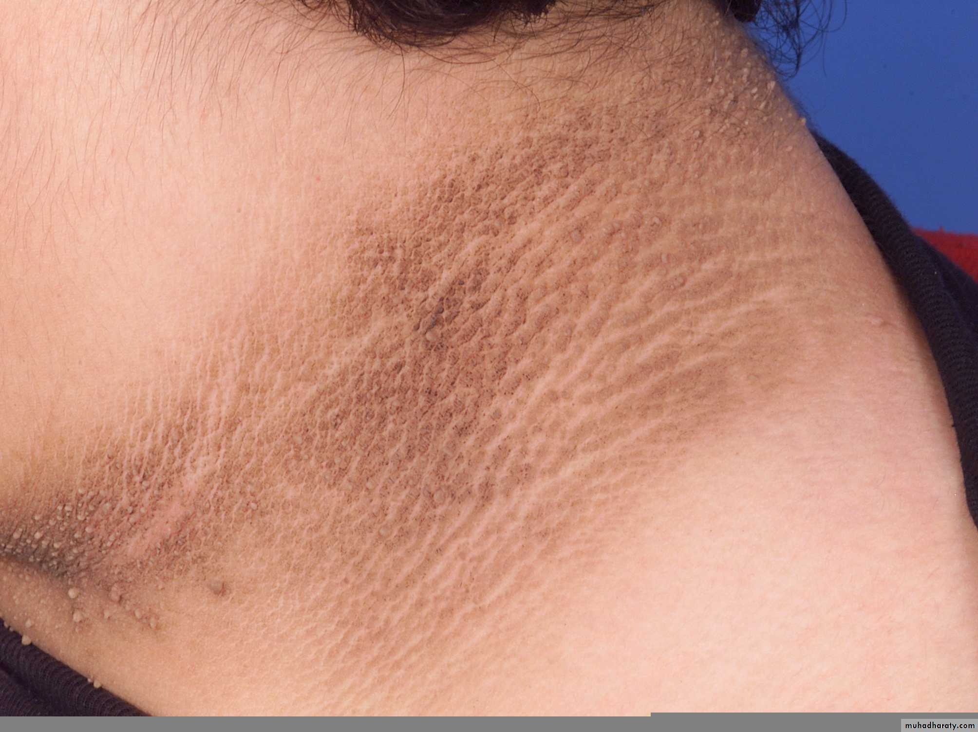Manifestations of Systemic Diseases