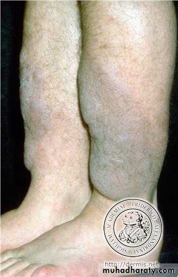Manifestations of Systemic Diseases