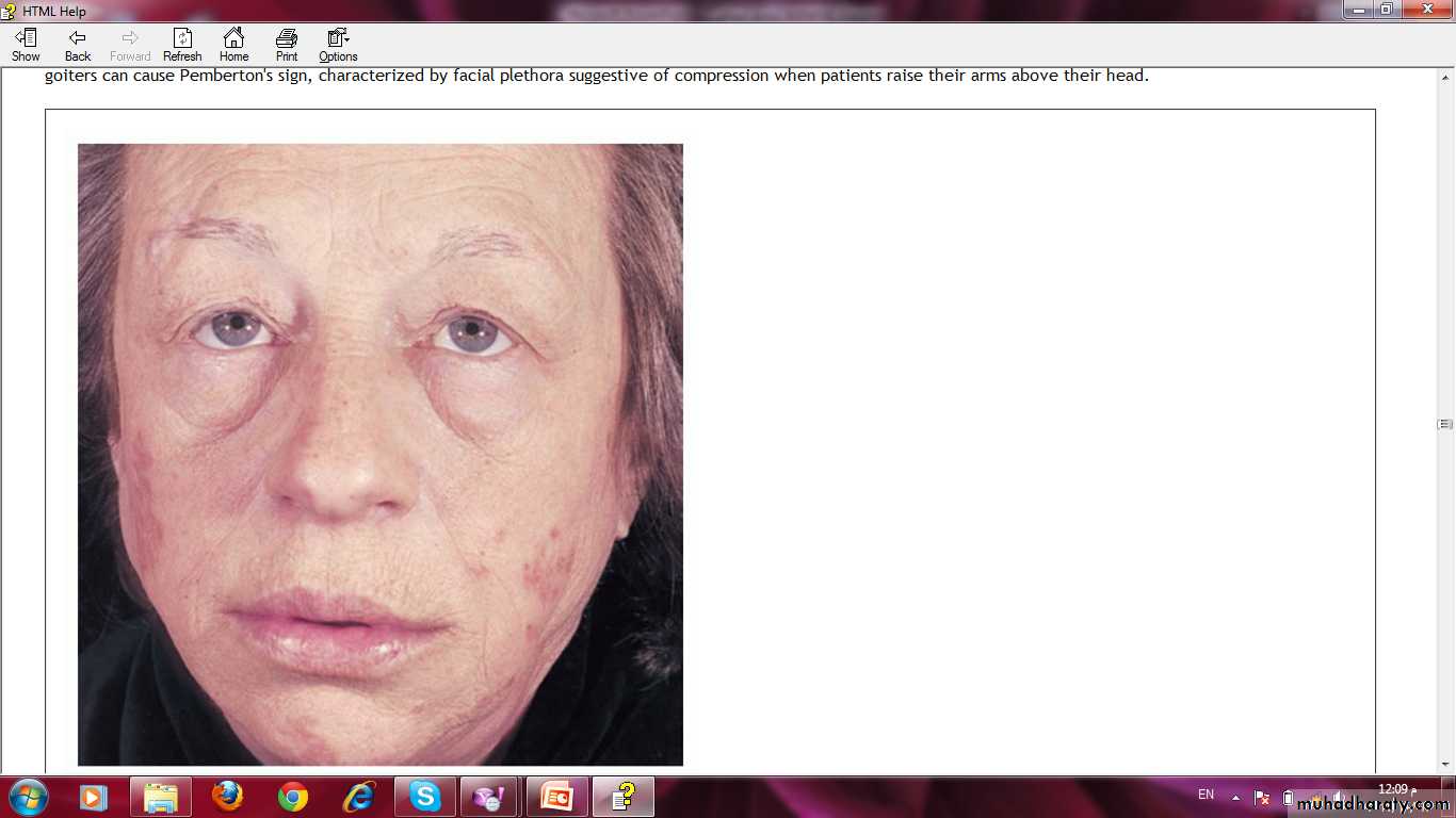 Manifestations of Systemic Diseases