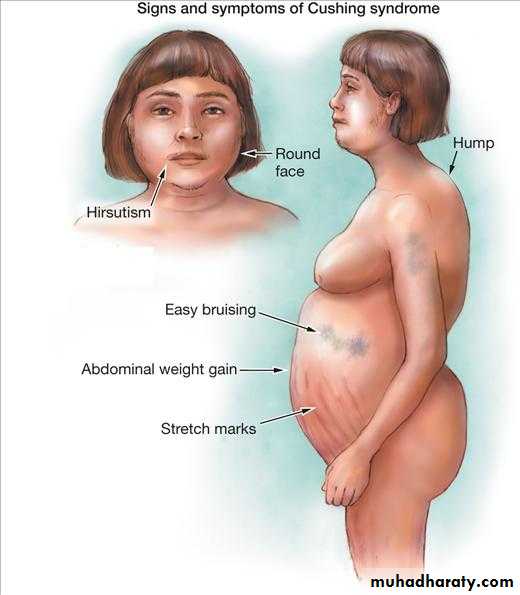 Manifestations of Systemic Diseases
