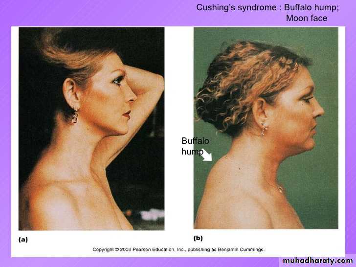 Manifestations of Systemic Diseases
