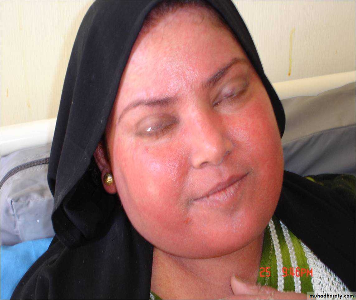 Manifestations of Systemic Diseases