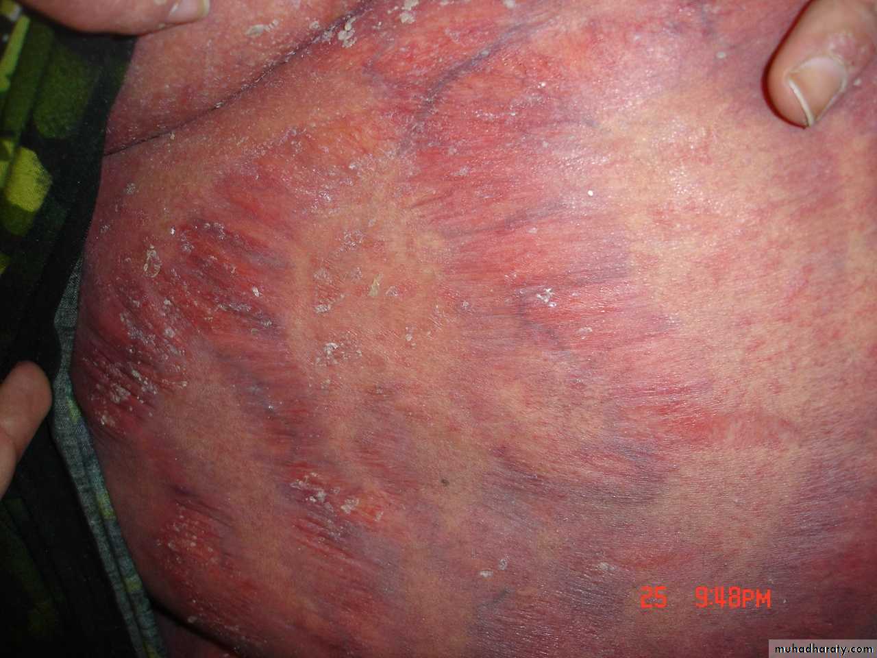 Manifestations of Systemic Diseases