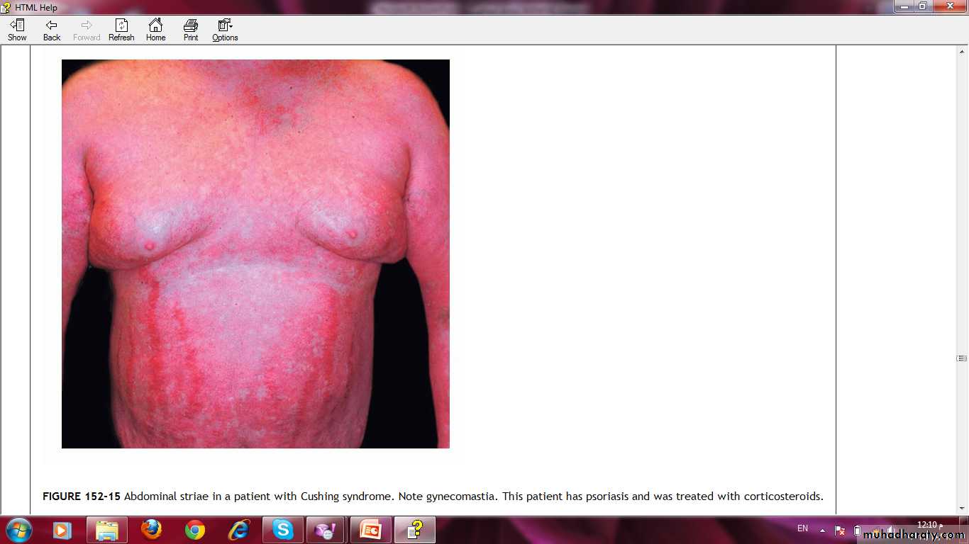 Manifestations of Systemic Diseases