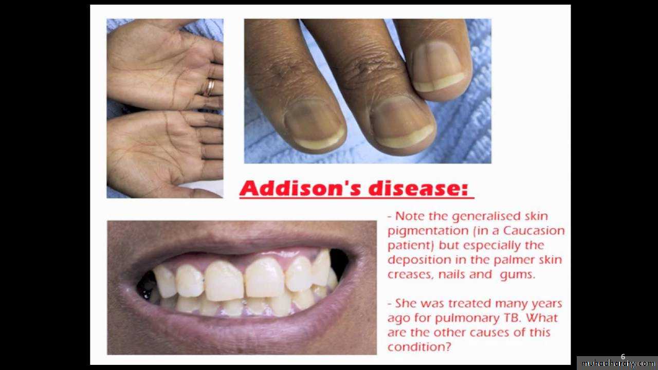 Manifestations of Systemic Diseases